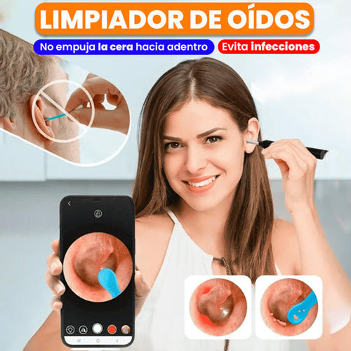 Limpiador de Oídos con Cámara HD y Protección de Tímpano | Seguro y Efectivo