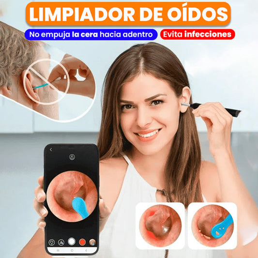 Limpiador de Oídos con Cámara HD y Protección de Tímpano | Seguro y Efectivo
