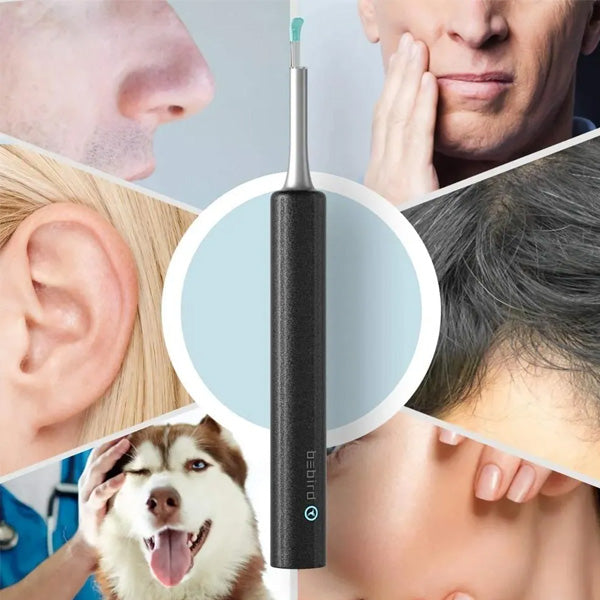 Limpiador de Oídos con Cámara HD y Protección de Tímpano | Seguro y Efectivo