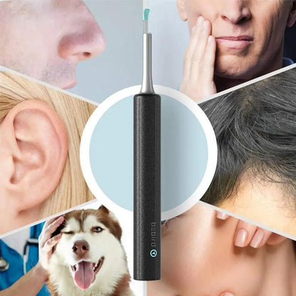 Limpiador de Oídos con Cámara HD y Protección de Tímpano | Seguro y Efectivo