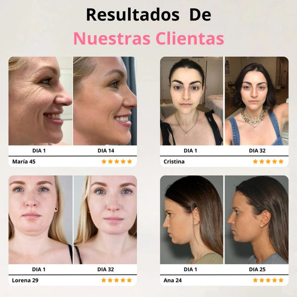 Masajeador Facial con Microcorriente
